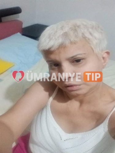 Alev fotoğrafı